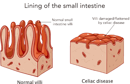 villi small intestine